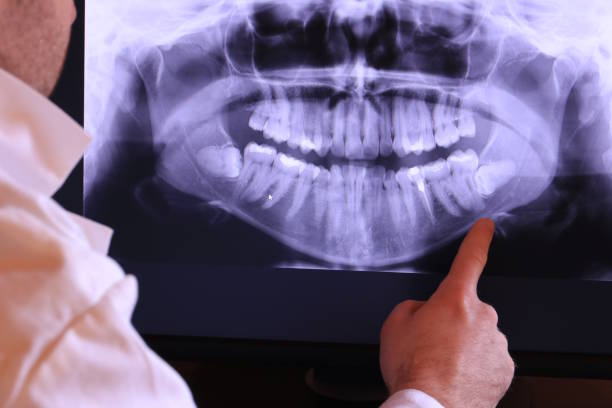 Best Broken or Cracked Tooth Emergency Dentist in Island Park, NY